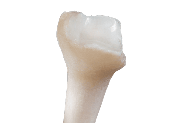Cryo distal tibia with cartilage